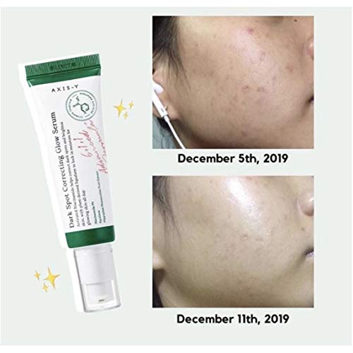 AXIS-Y Dark Spot Correcting Glow Serum AsiaBeautyMall