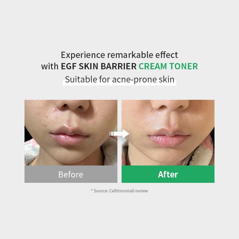 Z+PIDERM ECF Skin Barrier Cream Toner AsiaBeautyMall