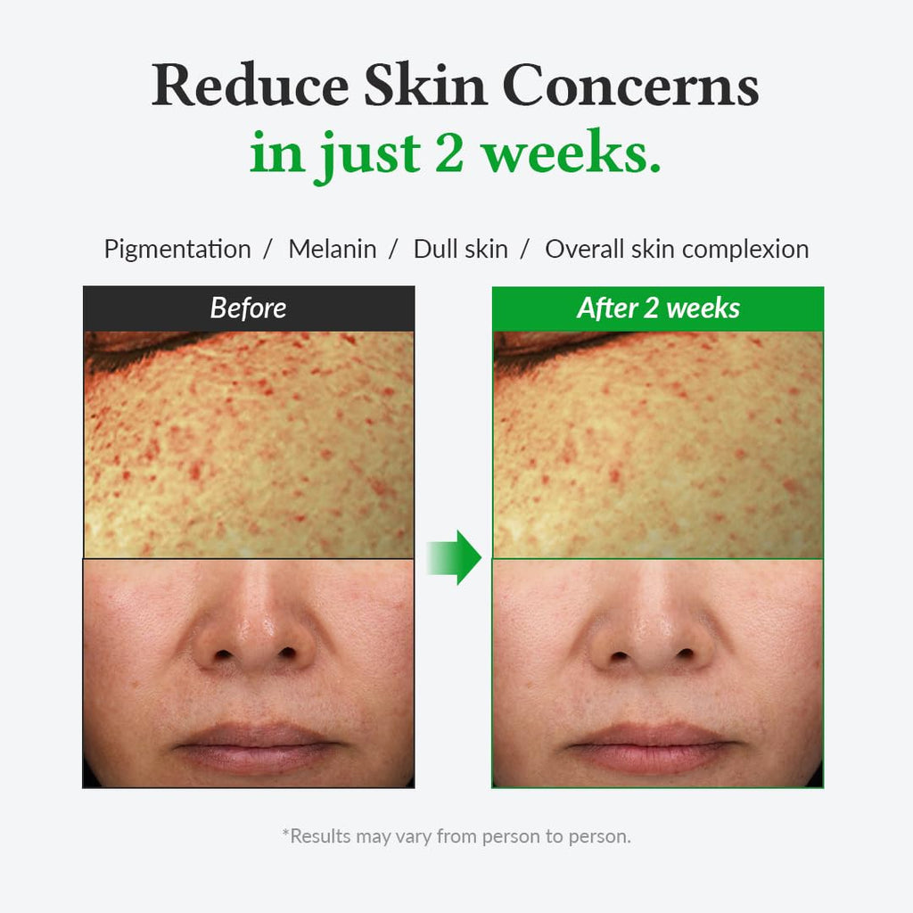 Dr. Althea Gentle Vitamin C Serum AsiaBeautyMall