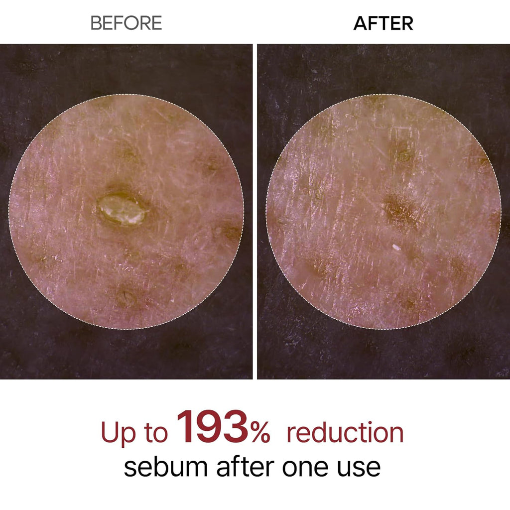Dr. Melaxin Peel Shot Exfoliant Black Rice Ampoule AsiaBeautyMall