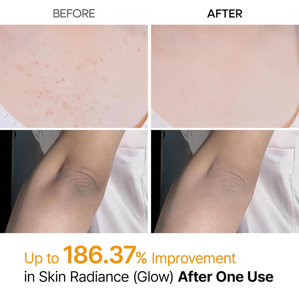 Dr. Melaxin Peel Shot Exfoliating Kojic Acid Turmeric Spray AsiaBeautyMall