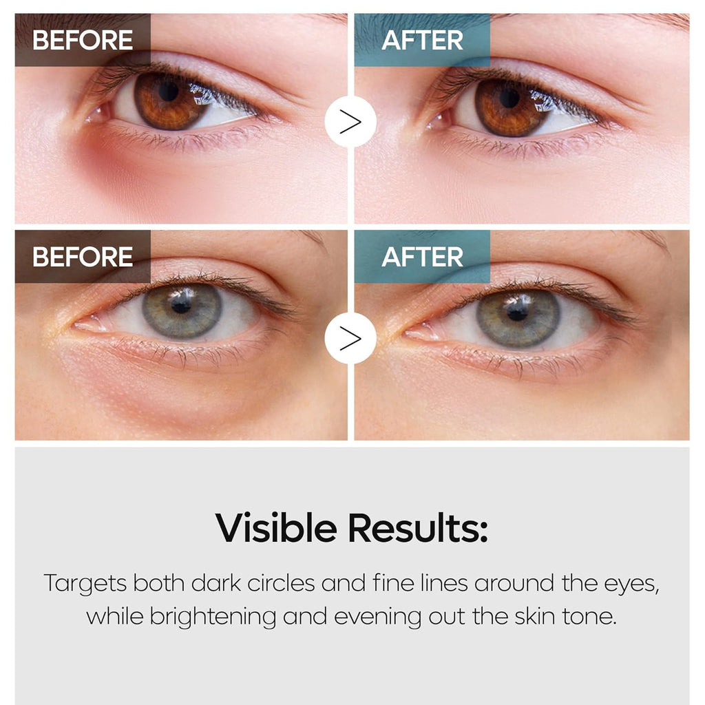 Dr. Melaxin TX Retinalsome Double Effect Eye Cream AsiaBeautyMall