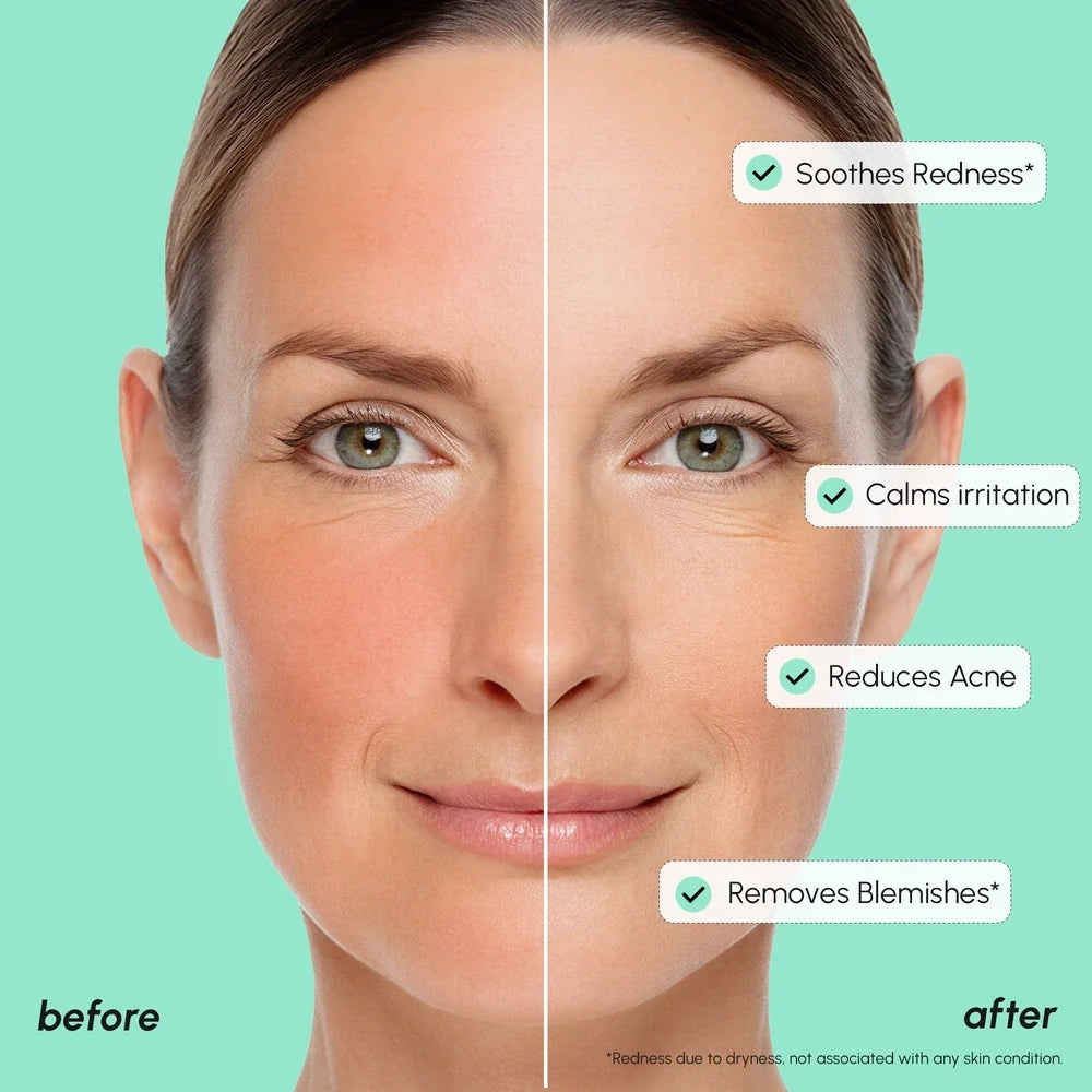 Redness Soothing Azelaic Acid Serum Maree