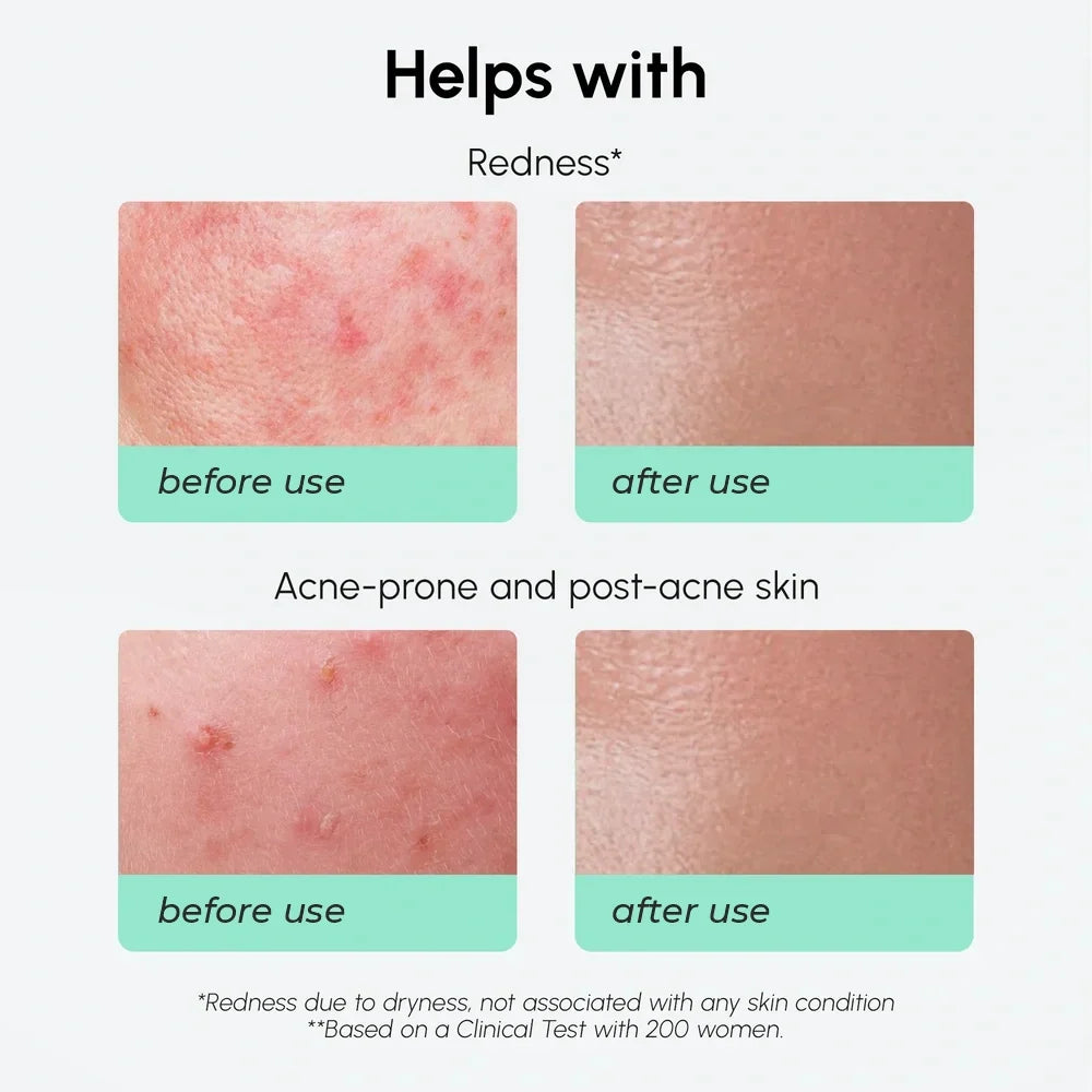 Redness Soothing Azelaic Acid Serum Maree