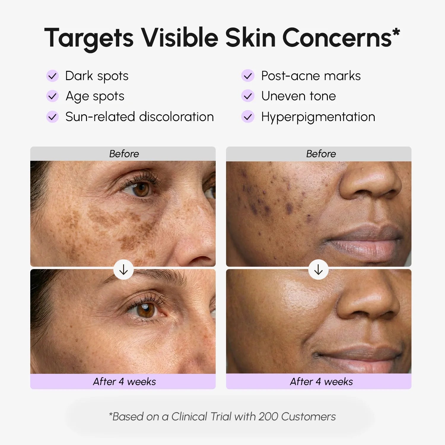 Face & Body Serum for Dark Spots Maree