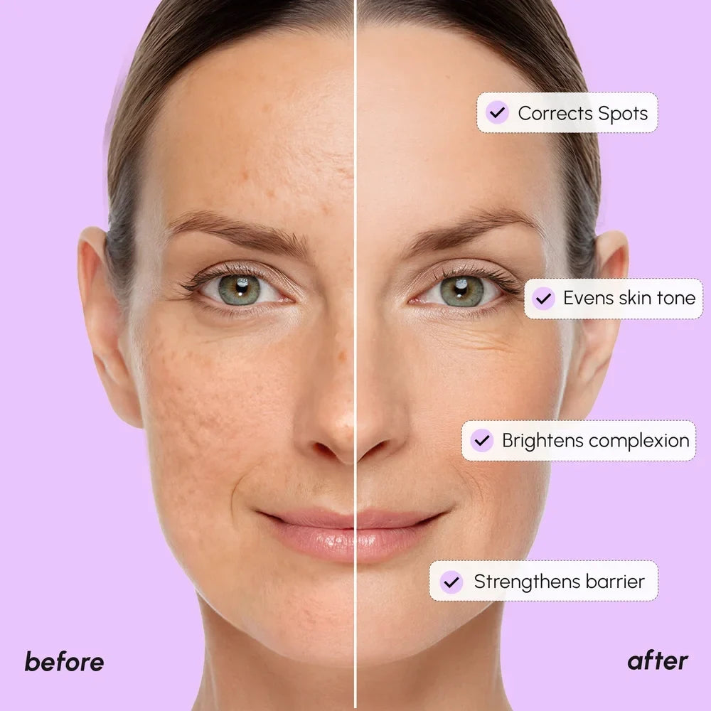 Dark Spot Corrector Maree