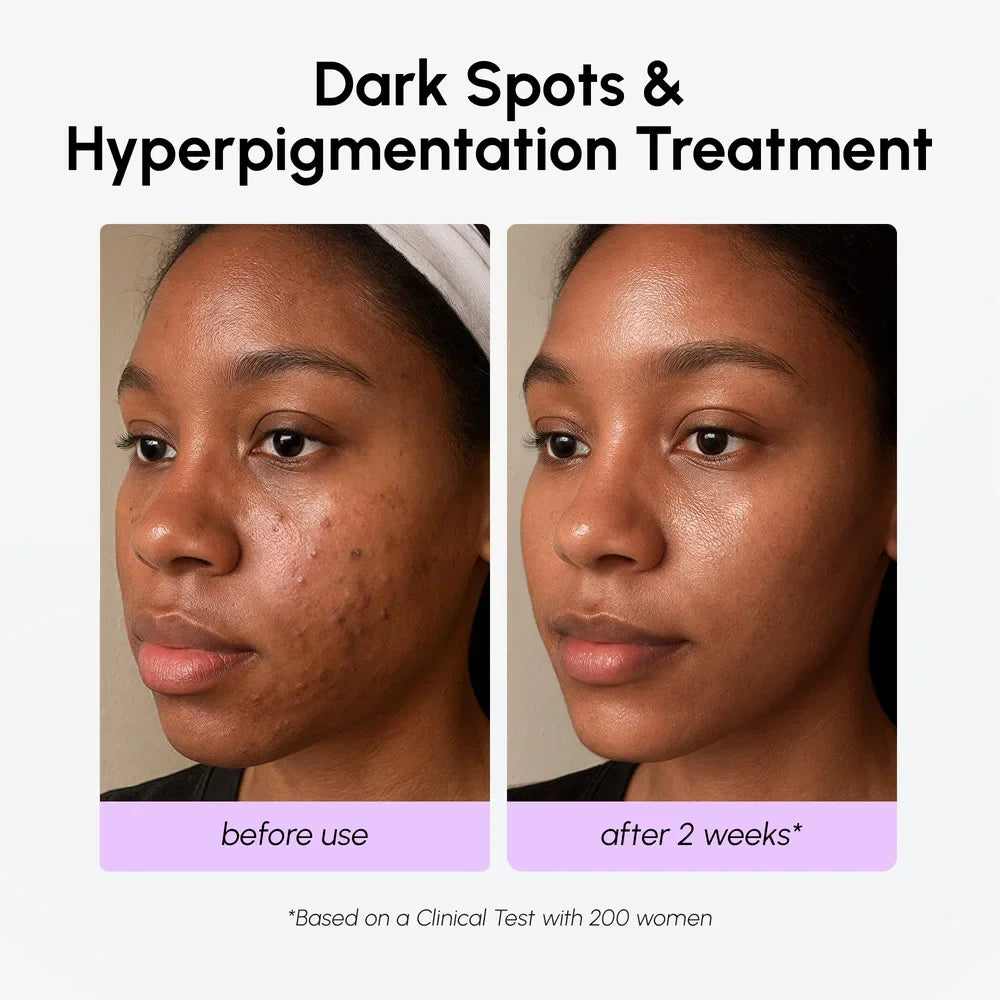 Dark Spot Corrector Maree