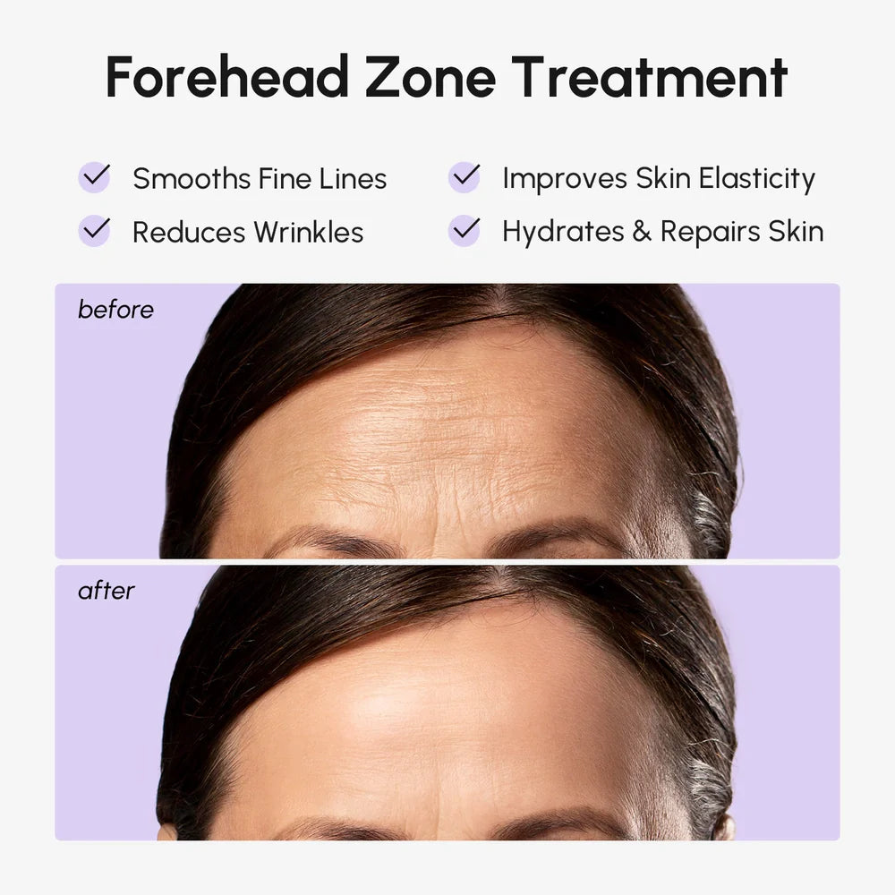 Anti-Wrinkle Forehead Patches Maree