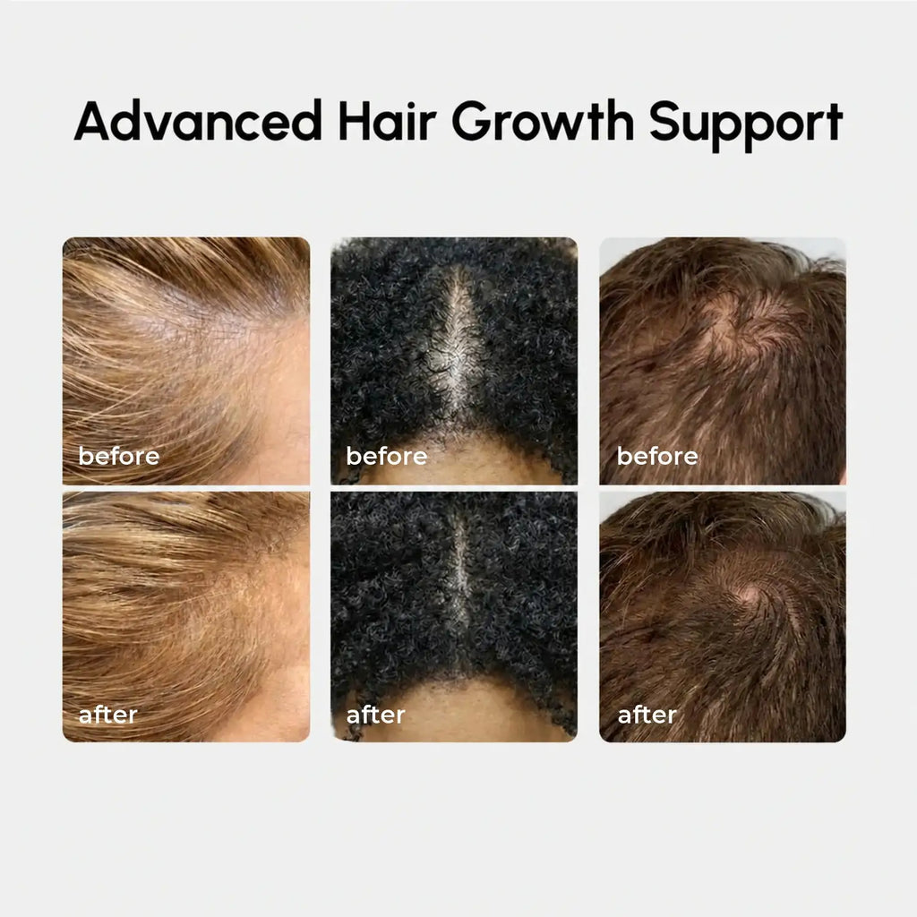 4-in-1 Hair Growth Spray Maree