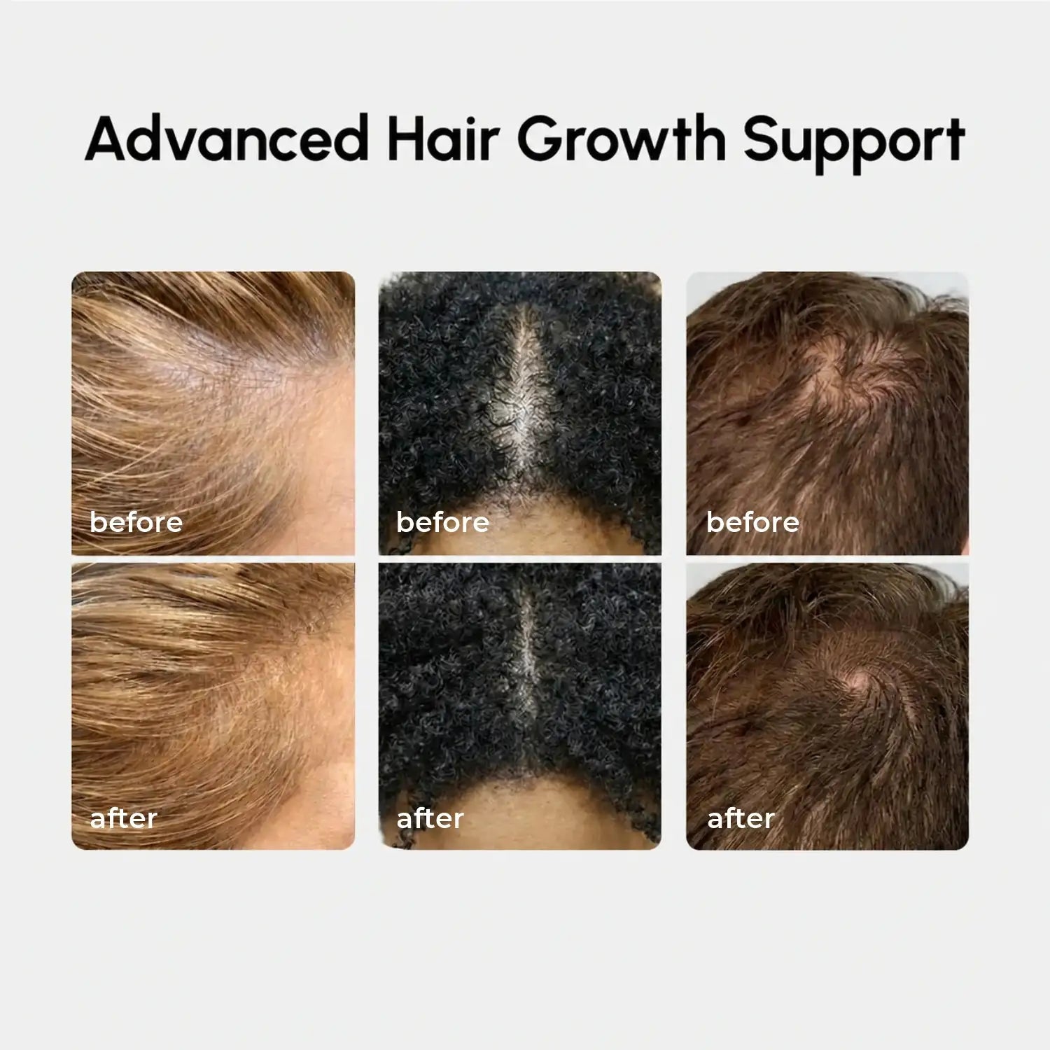 4-in-1 Hair Growth Spray Maree