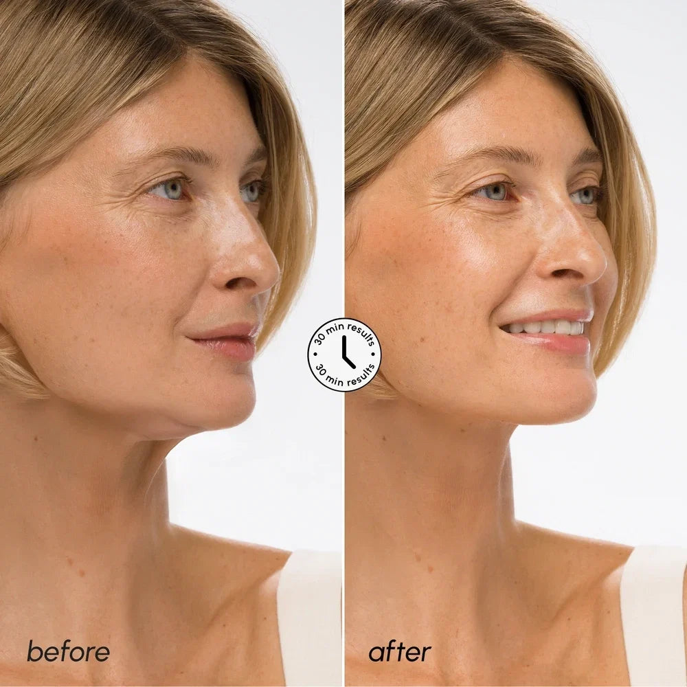 Hyaluronic Acid V-line Lifting Mask Maree