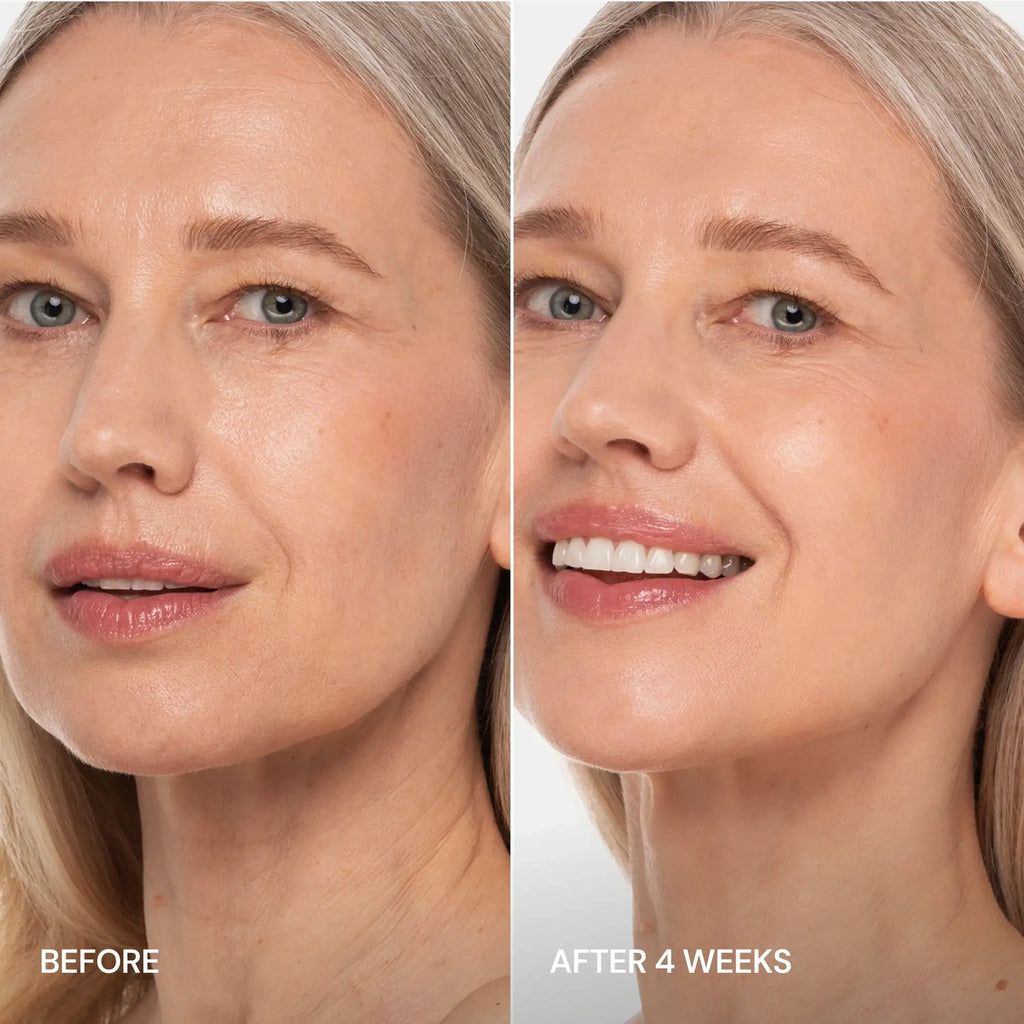 Pro-Retinol Neck Lifting Cream Massager Maree