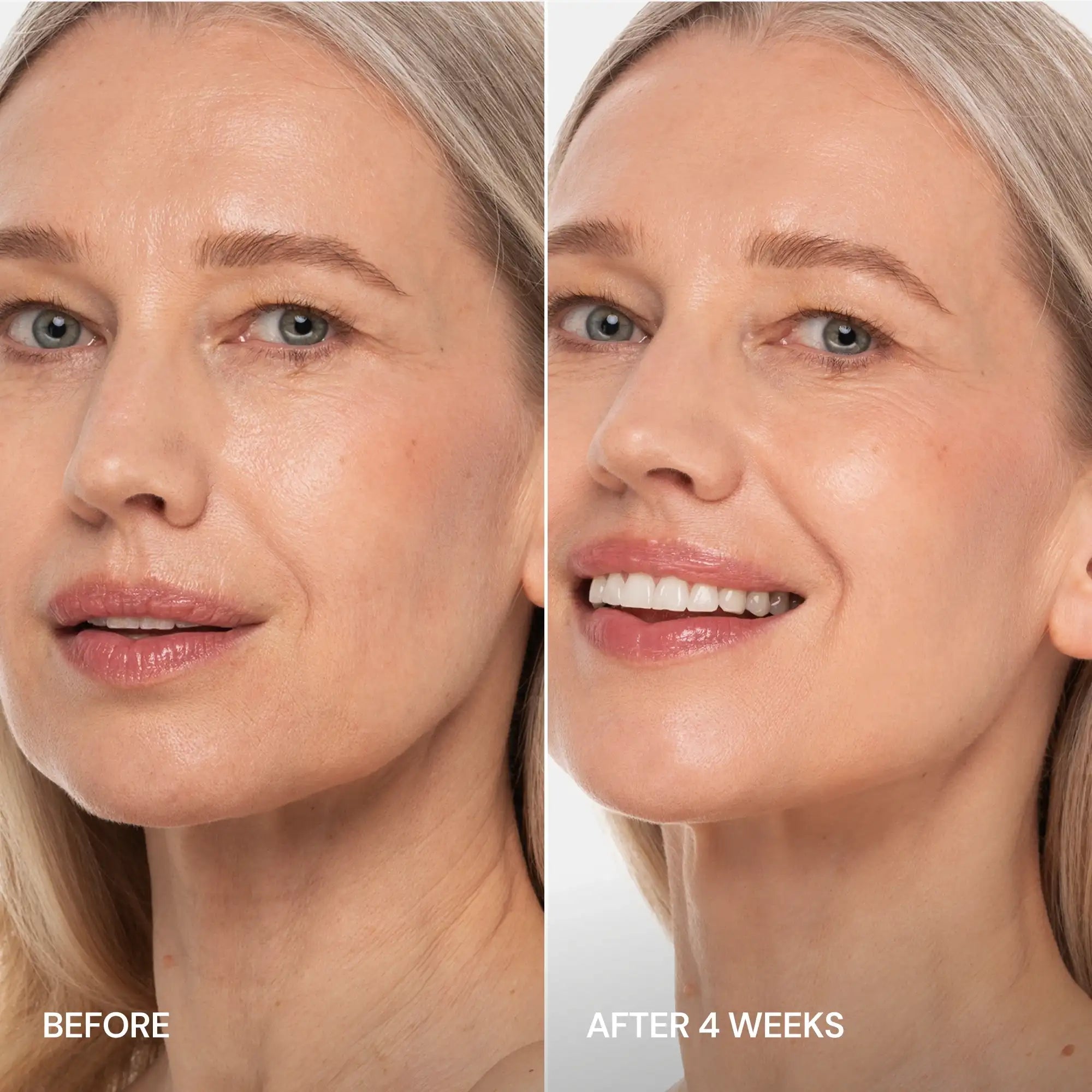 Pro-Retinol Neck Lifting Cream Massager Maree