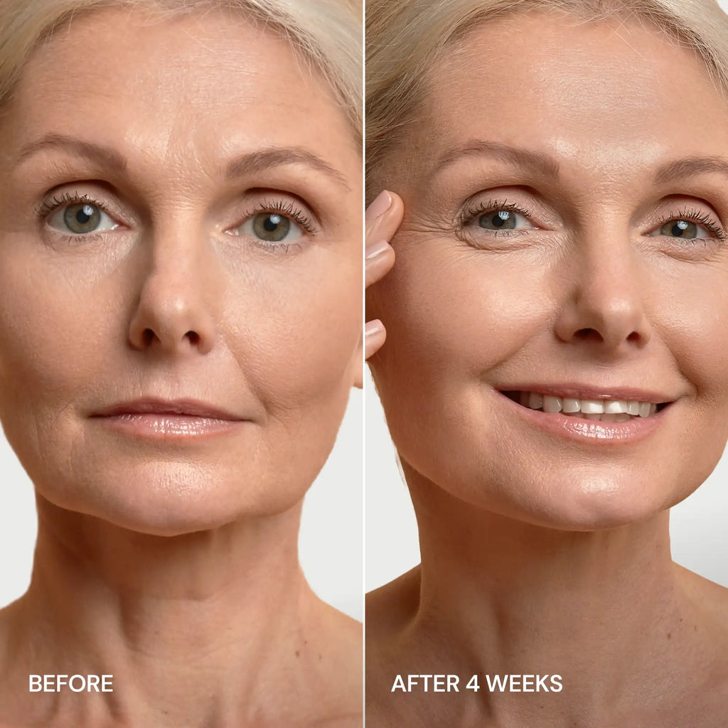 Pro-Retinol Neck Lifting Cream Massager Maree