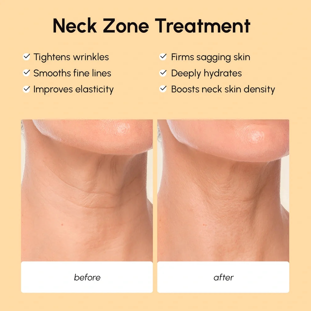 Lifting Neck Wrinkle Patches Maree