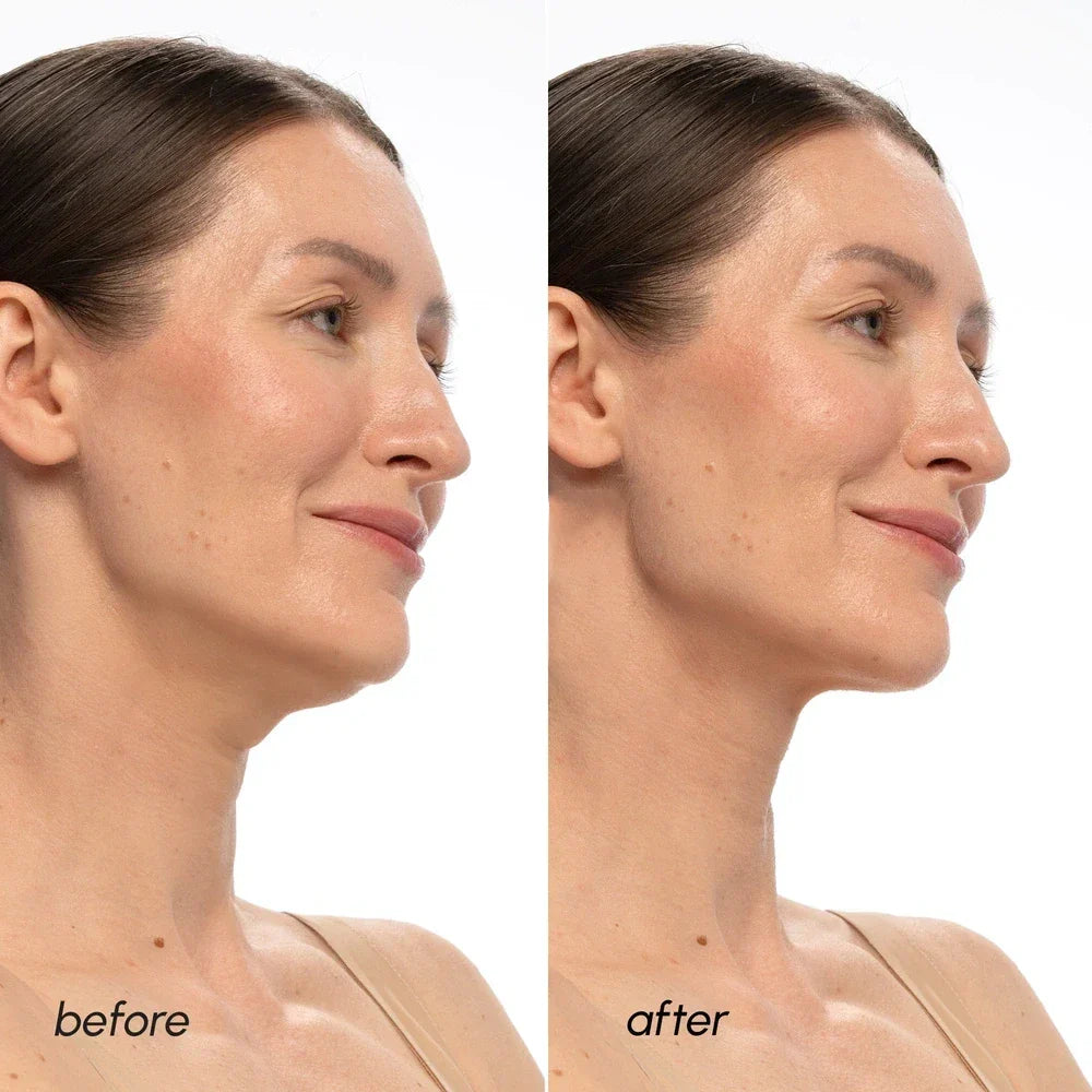 PDRN V-line Lifting Mask Maree