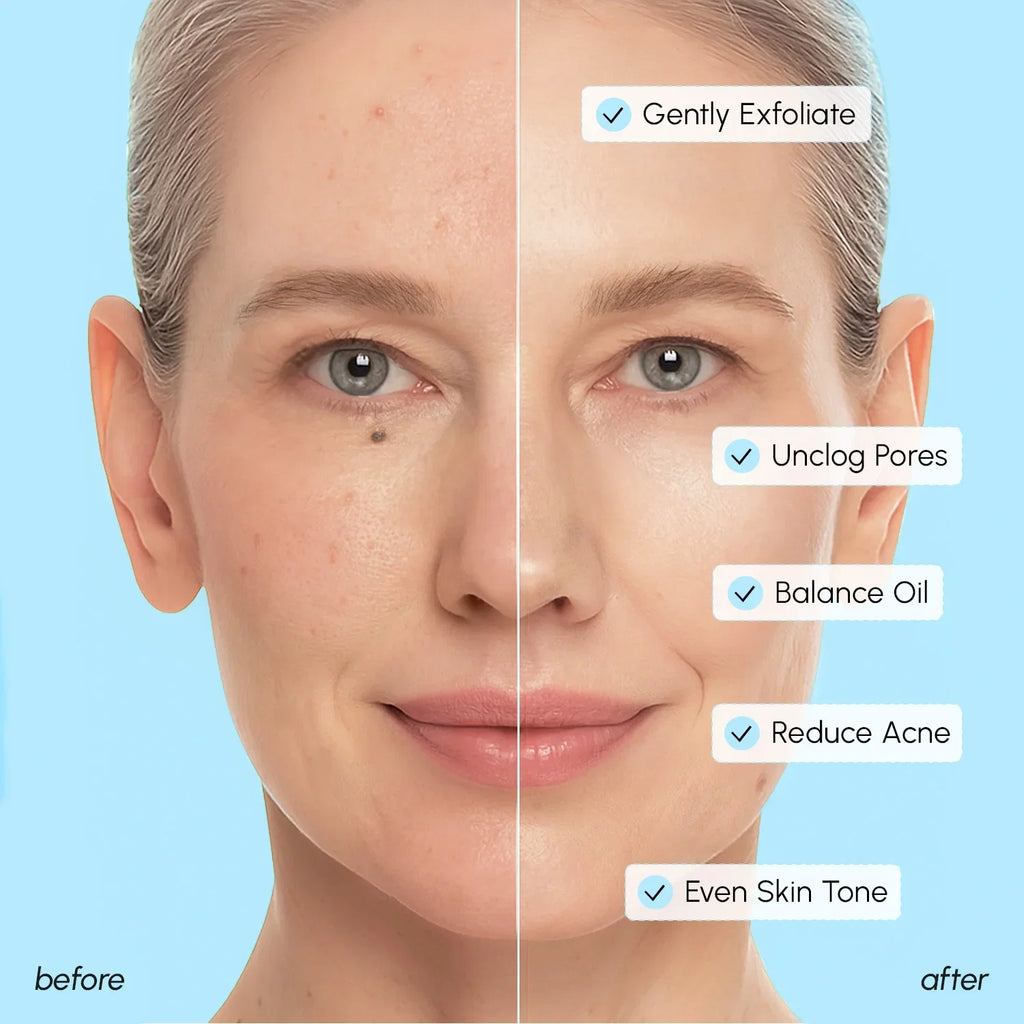 Glycolic & Salicylic Acid Peel Pads Maree
